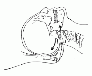 osteopatía craneo sacral